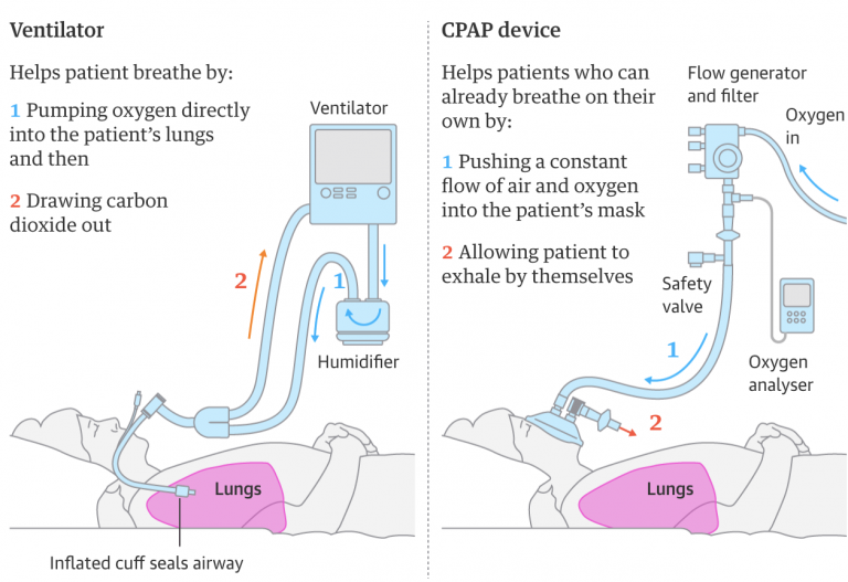 Mercedes F1 team developed a breathing aid for Covid-19 patients ...